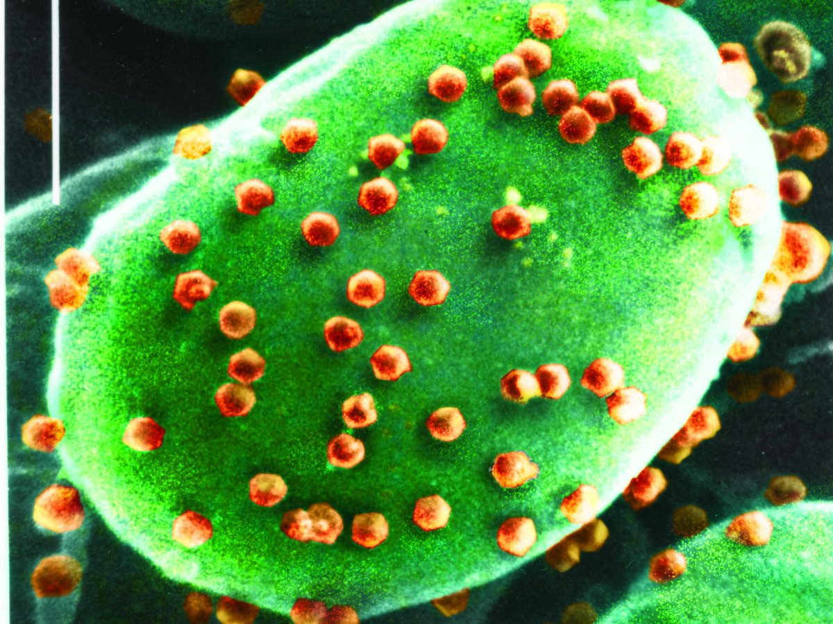 Algae Virus that Affects Humans